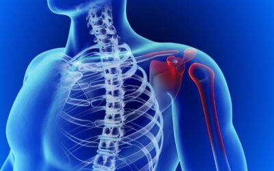 Rotator Cuff Surgery Recovery: What You Can Expect At Home