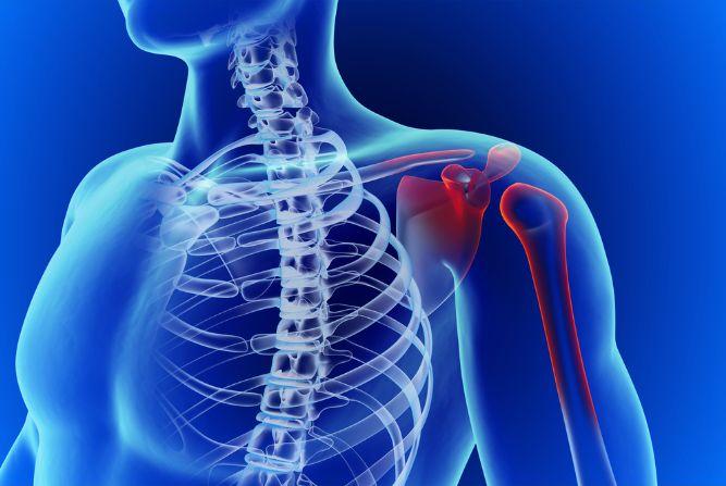 Rotator Cuff Surgery Recovery: What You Can Expect At Home