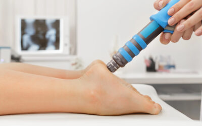 Shockwave Therapy For Plantar Fasciitis: A Non-Invasive Treatment For Heel Pain Relief